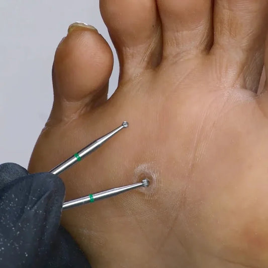Corn Remover Bit