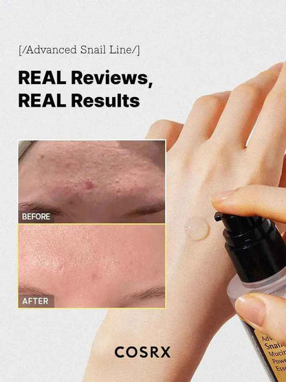 COSRX Advance Snail 96 Mucin Power Essence 100 ml - DOKAN