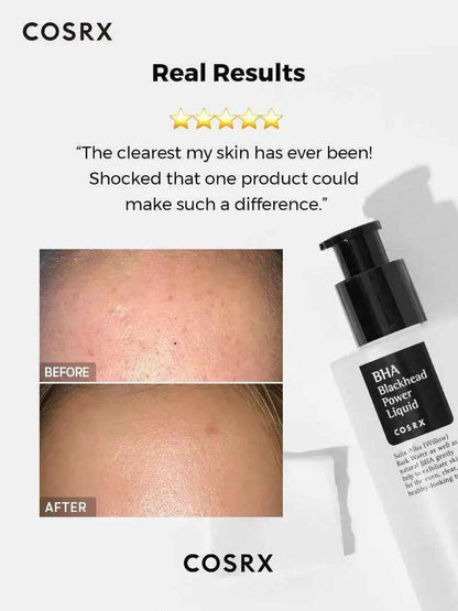 COSRX BHA Blackhead Power Liquid 100 ml - DOKAN