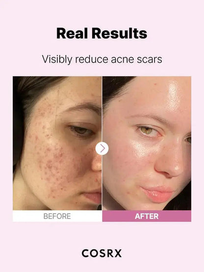 COSRX The Niacinamide 15 Serum 20 ml - DOKAN