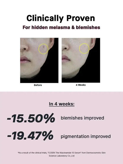 COSRX The Niacinamide 15 Serum 20 ml - DOKAN
