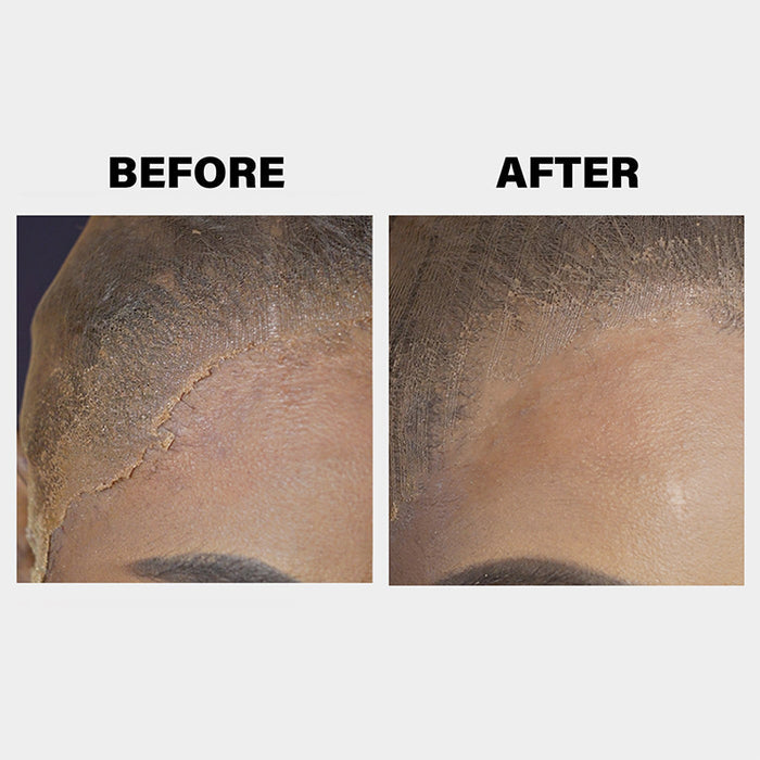 EBIN lace melt spray for wigs before and after close up showing melted lace blending at hairline