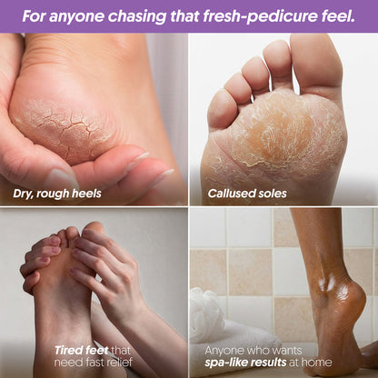 Furr FURR Foot Rejuvenation Kit