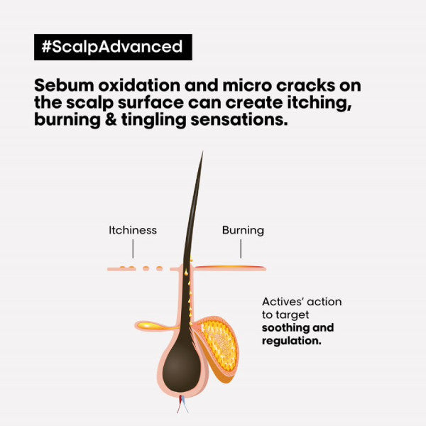 L'Oreal Scalp Advanced Anti-Discomfort Dermo-Regulator Shampoo 300ml