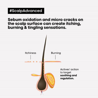 L'Oreal Scalp Advanced Anti-Discomfort Dermo-Regulator Shampoo 300ml